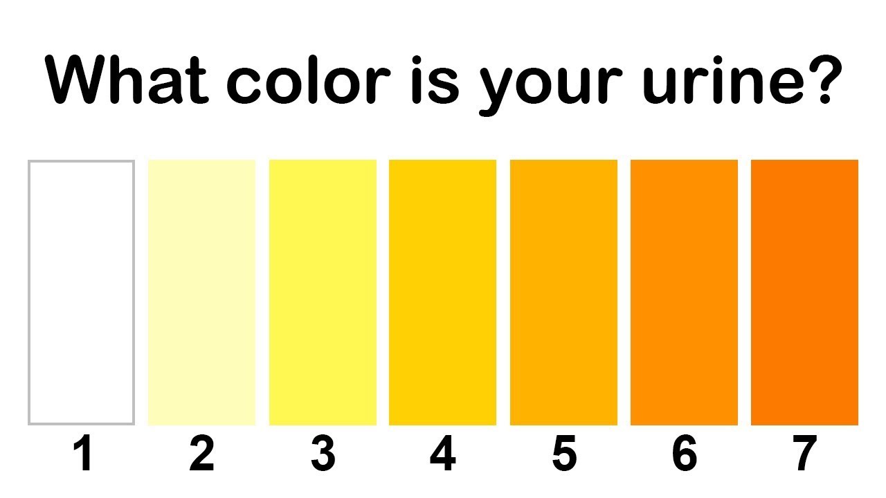 yellow color urine